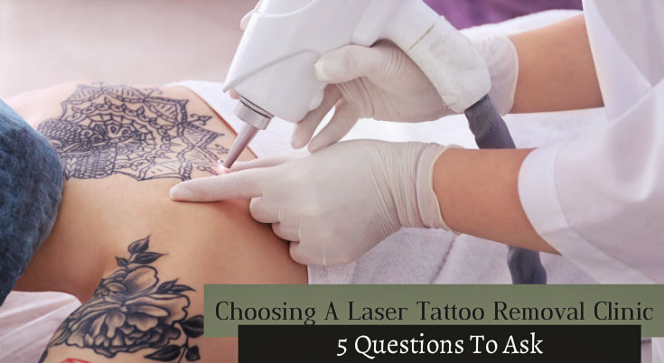 choosing-a-laser-tattoo-removal-clinic-5-questions-to-ask
