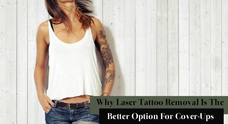 why laser tattoo removal is the better option for cover-ups