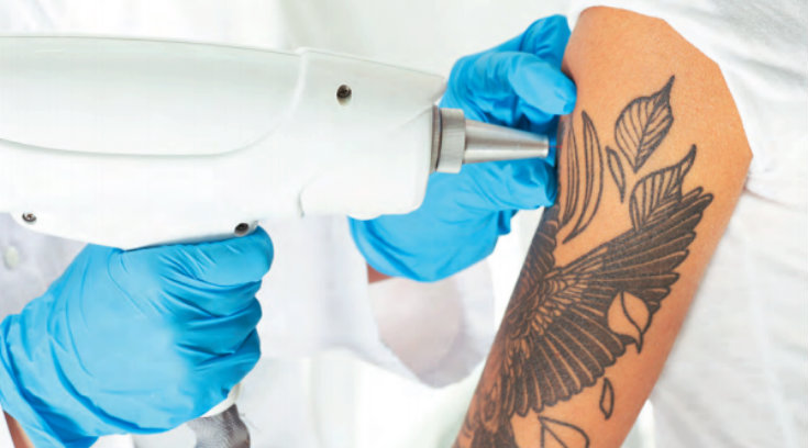 relationship-between-the-lymphatic-system-and-laser-tattoo-removal