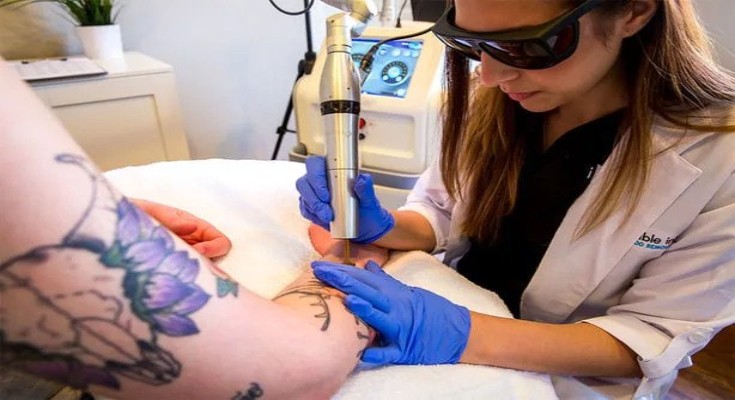 is-your-tattoo-removal-clinic-safe