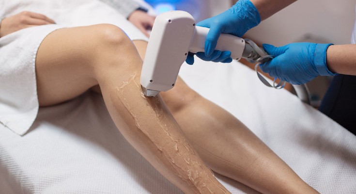how-long-does-laser-hair-removal-last