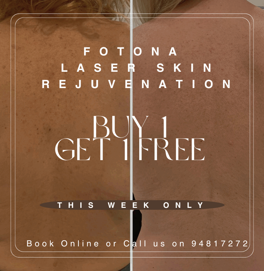 Fotona Laser Skin Rejuv Buy1free1