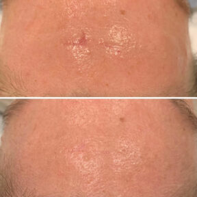 BIO-Before-After-PIC2