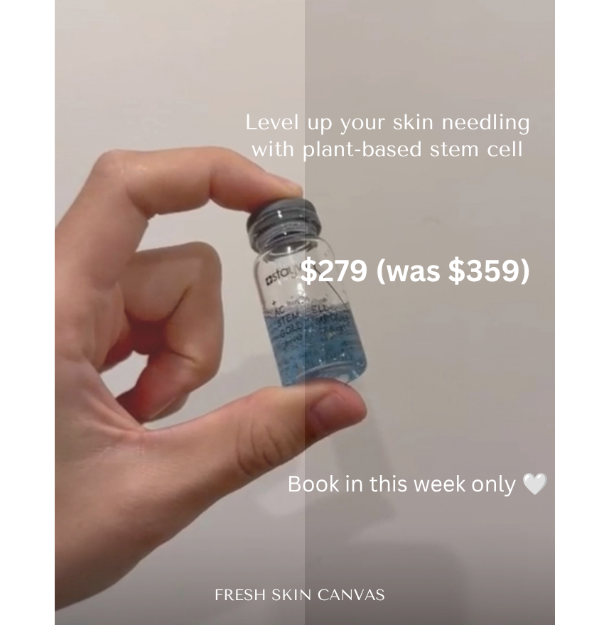 Skin Needling with plant based stem cell